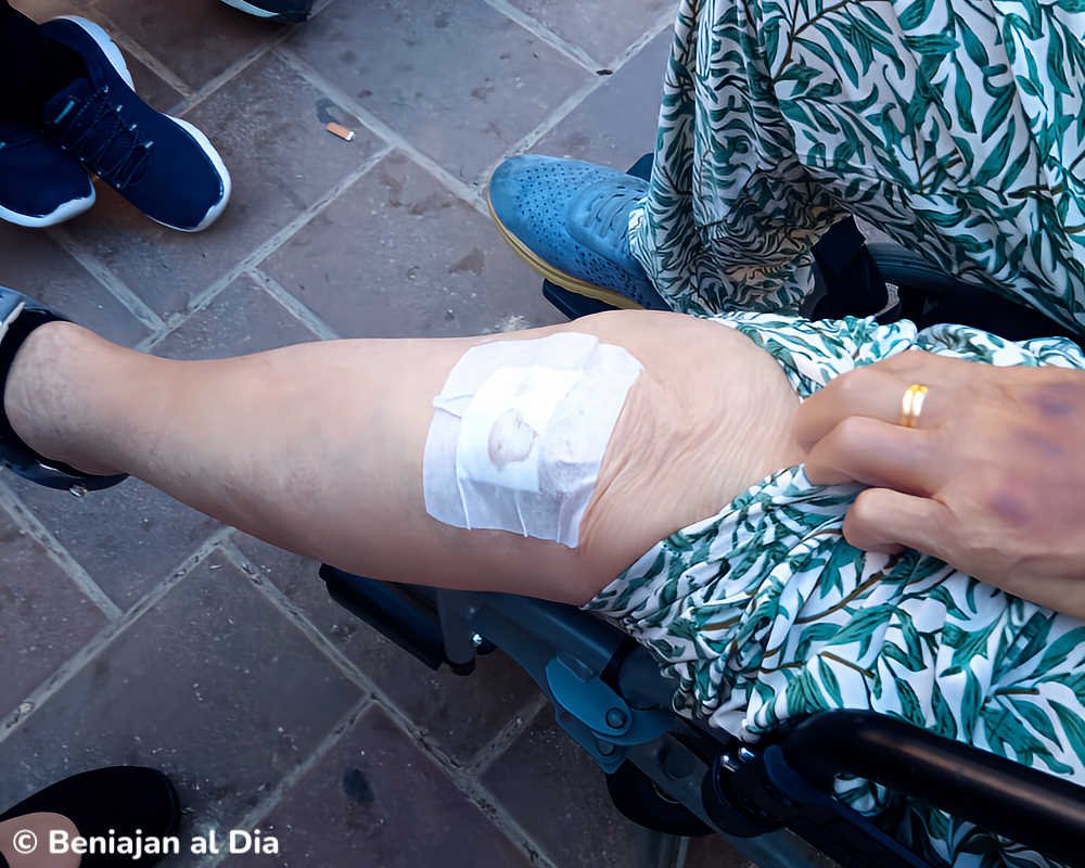 Herida en la rodilla izquierda de Manoli tras el accidente en Beniaján